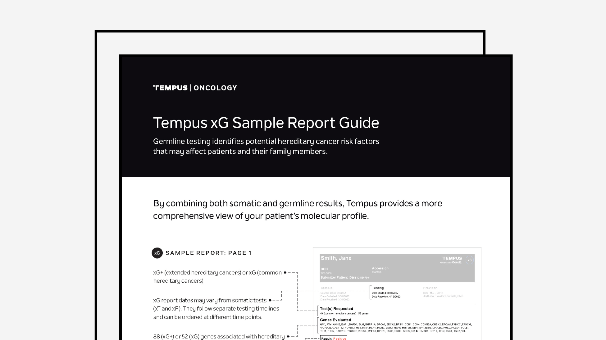 Tempus xG Sample Report Guide