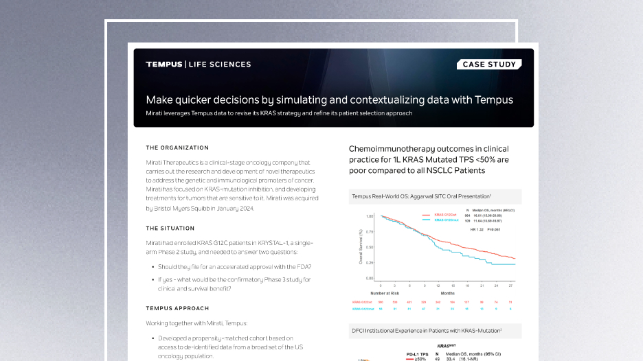 Make quicker decisions by simulating and contextualizing data with Tempus