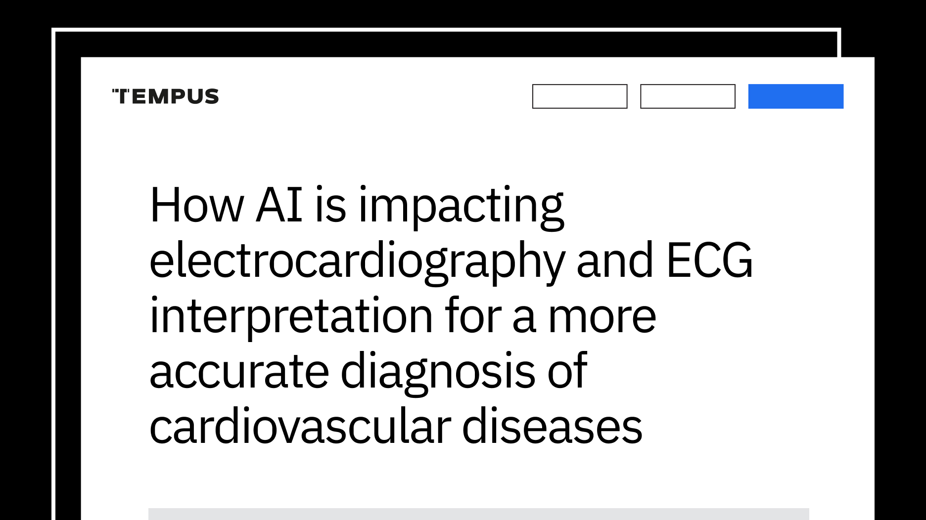 How AI is impacting electrocardiography and ECG interpretation for a more accurate diagnosis of cardiovascular diseases
